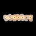 Настенный светильник Loft IT Alicante 10248/7W